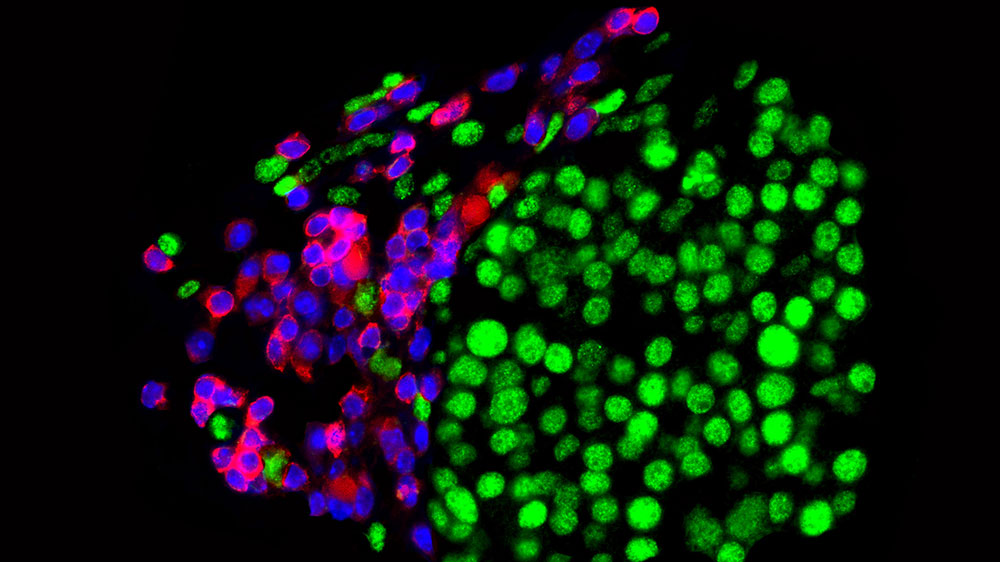 The epigenetic control protein Ezh2 plays a central role in how cancer cells develop resistance. (Bild: D. Zingg, UZH)